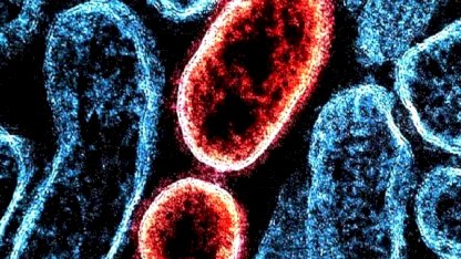 Hindistan'da Nipah Virüsü Salgını