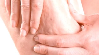 Prof. Dr. Karacalar’dan selülit uyarısı: Portakal kabuğu görüntüsü basit sorun değil!