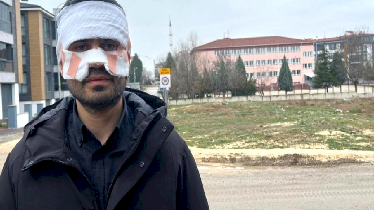 Eskişehir'de rehber öğretmeni, fizik öğretmeninin yüzüne sıcak çay fırlattı