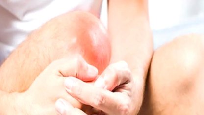 Diz ağrısını hafife almayın! Dizinizdeki 'çıt' sesi masum olmayabilir