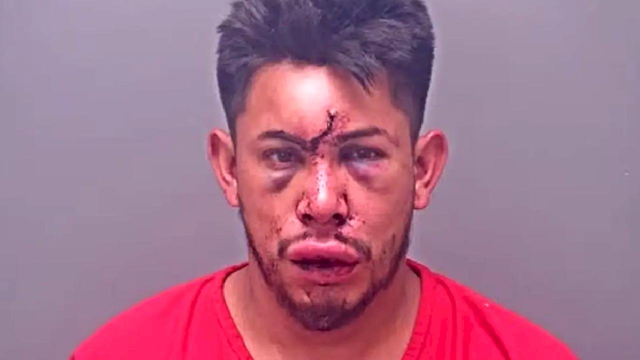 13 yaşındaki çocuk, evdeki olayı görünce babasını bu hale getirdi