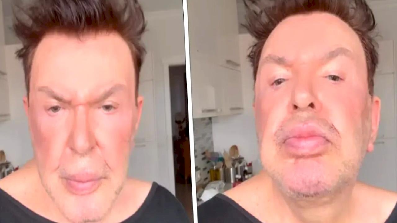 Kuşum Aydın estetik sonrası son halini paylaştı! Değişimi gündem oldu