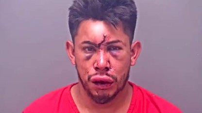 13 yaşındaki çocuk, evdeki olayı görünce babasını bu hale getirdi