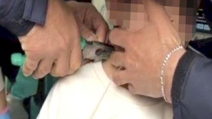 Adıyaman’da boynu plastik kelepçeyle sıkışan çocuk kurtarıldı