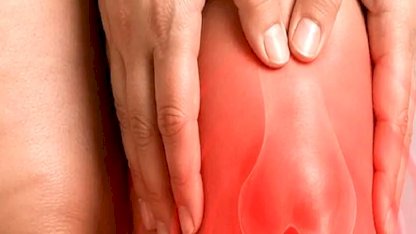 Diz biyomekaniğini bozan süreç: Lipödem