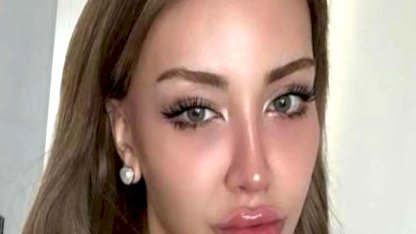 Mika Raun Gerçek İsmi Ne?